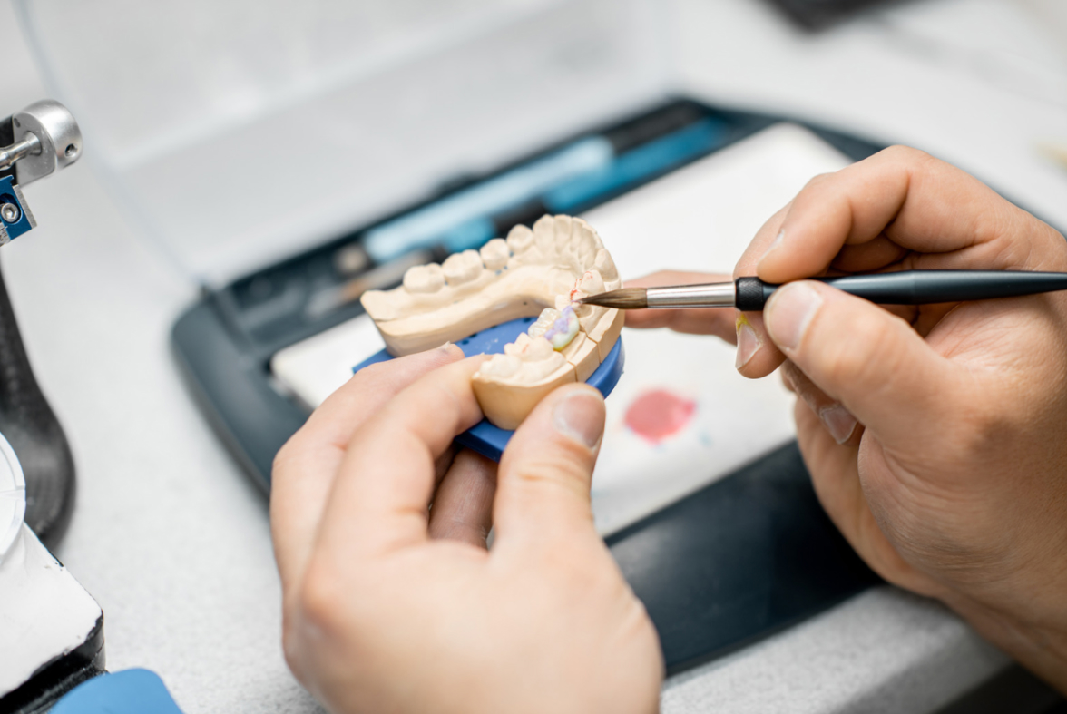 Dental technician applying colour to a full-arch prosthesis on an upper jaw model, demonstrating Malo Clinic standards in custom implant restoration.